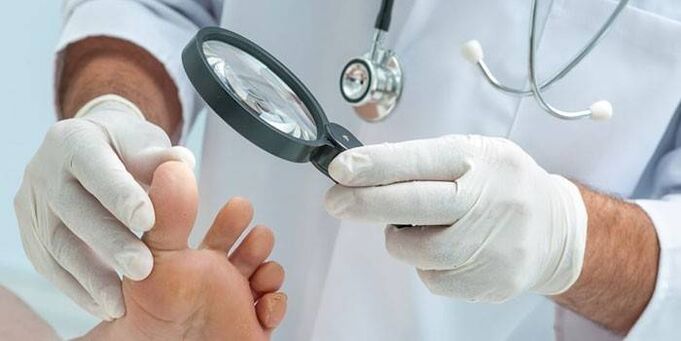 Gydytojas spygliuku su padidinamuoju stiklu apžiūri paciento pėdą