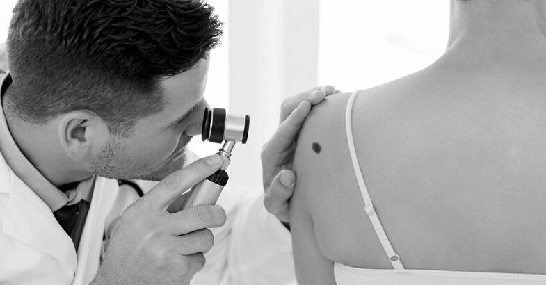 specialistas diagnozuoja karpos tipą